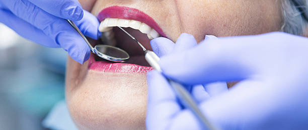 Best Emergency Treatment for Toothache in East Whittier, CA